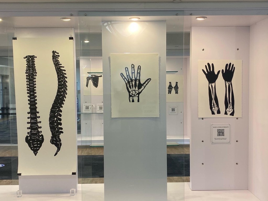 View of a display case. Large paper cuts (black paper cut paper on soft white watercolor paper) of the spine (two views), the hand, and the hand and arm. Behind the display case another case is visible. We can see a papercut of the shoulder and the elbow.