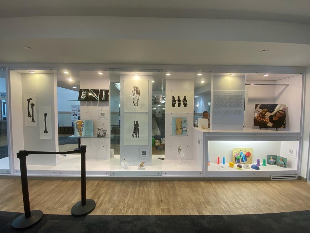 A long view of a display case. There are paper cuts - black cut paper on white paper of the bones of the leg and arm, the foot, the ankle, and the knee. There are popups of a knee receiving arthroscopic surgery and another leg in an external fixator. There re devices next to each item - 3d printed ankles, feet, knees, as well as an external fixator
