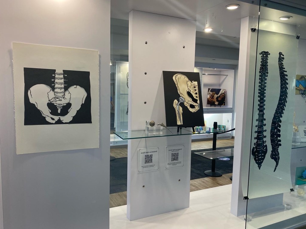 View of a display case. On the far left is a paper cut of a pelvis. Next to it is a pop-up of a pelvis and femur, connected by a grey ball and rod. On a clear pedestal net to it is an actual hip implant - a silver ball, next to a long rod. To the left is a long (6 food) papercut of two views of the spine. black paper cut out on white paper