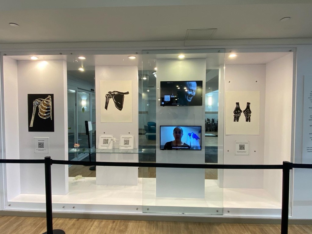 View of a display case. A pop-up of a ribcage, shoulder, and arm with an implant. In front of it is an actual implant. There are two papercuts - one of a shoulder, the other of the elbow. There are display cases with people speaking.